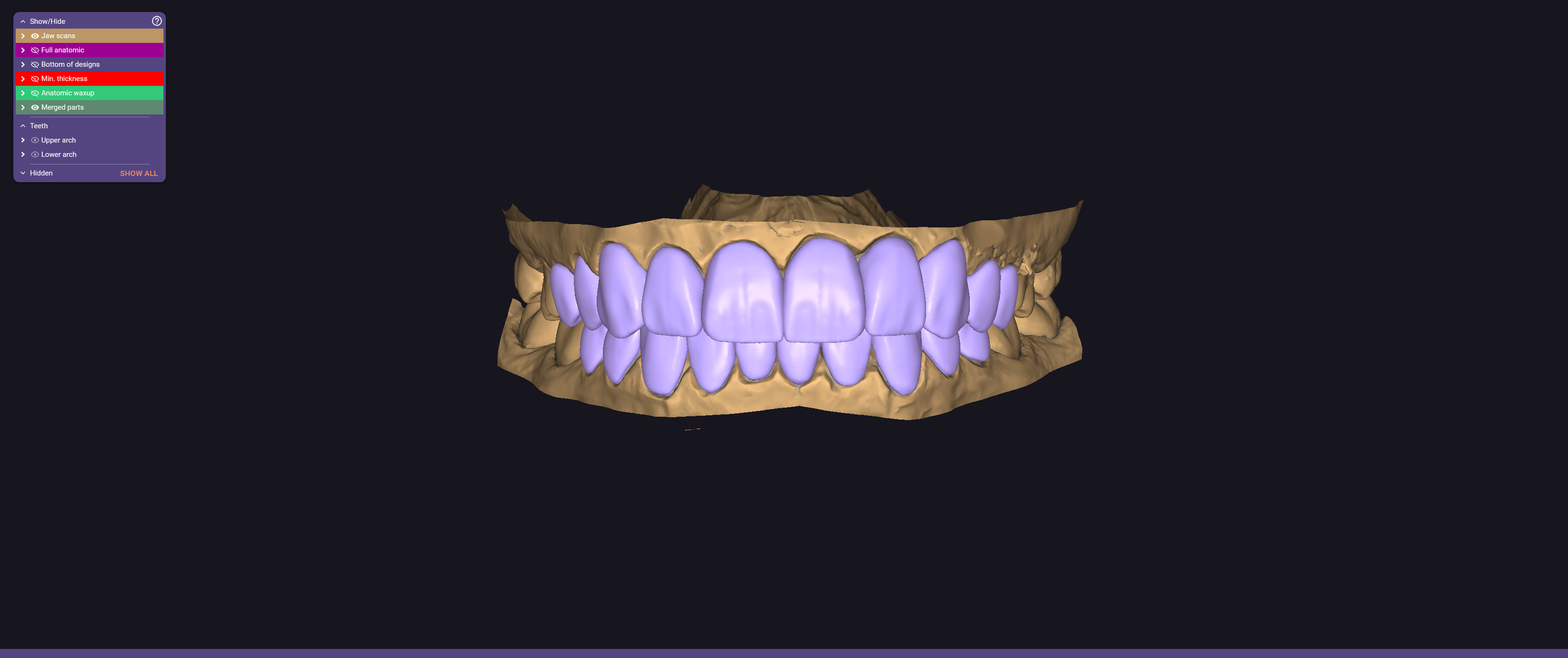Exocad full smile digital dental design case